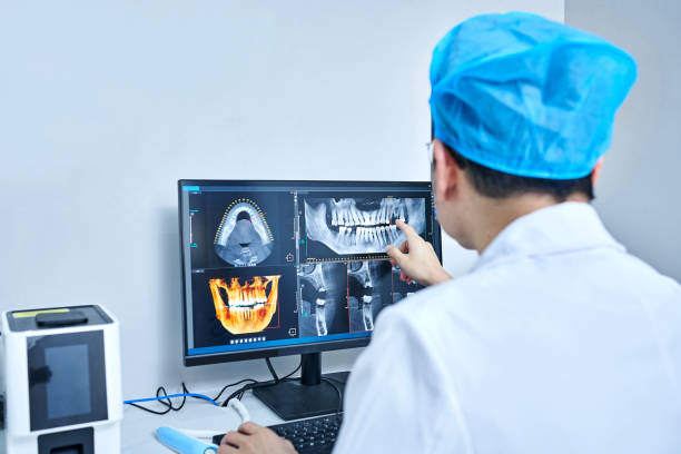 Best Emergency Dental Extractions in Davenport, FL
